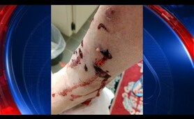 Raccoon attacks Tampa woman